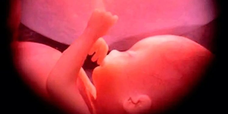 Vermont votes to enshrine abortion in constitution, news outlet projects