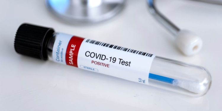 FACT CHECK: Did 118 participants at the Synod on Synodality really come down with COVID?