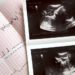 Study: Texas fertility rate rose after ‘Heartbeat Act’