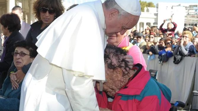 Man with disfigured face whose embrace with Pope Francis touched the world dies
